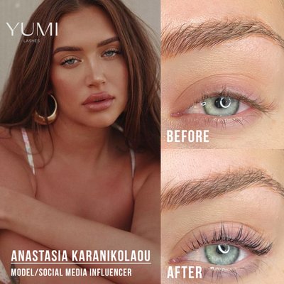 YUMILashes: Anastasia Karanikolaou - Model and social media mogul Anastasia Karanikolaou comes in regularly for her lash lift and tint! Treatment included YUMI Premium Keratin Lash Lift with a lash tint add-on. The before and after results of her YUMI Lash Lift blow us away every time! With the tint add-on and continued use of her YUMI Lash Growth Serum, Stass has been able to grow her lashes longer, providing a more dramatic lift every appointment! YUMILashes: Anastasia Karanikolaou - Model and social media mogul Anastasia Karanikolaou comes in regularly for her lash lift and tint! Treatment included YUMI Premium Keratin Lash Lift with a lash tint add-on. The before and after results of her YUMI Lash Lift blow us away every time! With the tint add-on and continued use of her YUMI Lash Growth Serum, Stass has been able to grow her lashes longer, providing a more dramatic lift every appointment!