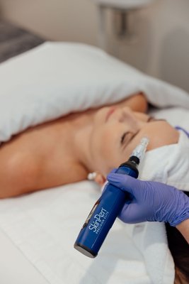Skin Pen - SkinPen microneedling is one of the most effective treatments for improving skin texture, stimulating collagen, and restoring a healthy glow. This FDA-cleared treatment works by creating thousands of precise micro-channels in the skin, triggering your body’s natural healing response and boosting collagen and elastin production.

Over time, this natural regeneration helps improve the appearance of:

• Fine lines and wrinkles
• Acne scars and other types of scarring
• Enlarged pores
• Uneven texture
• Dull or tired-looking skin
• Mild skin laxity

Many clients are surprised to see pinpoint bleeding during the treatment, and this is completely normal. In fact, it is a great sign. Pinpoint bleeding indicates the treatment has reached the optimal depth needed to stimulate collagen production and activate the skin’s natural renewal process.

After your SkinPen treatment, your skin may appear slightly red, similar to a mild sunburn, for about 24 to 48 hours. Over the following weeks, as new collagen forms, you’ll begin to notice smoother, brighter, healthier-looking skin.

At Bare Necessities Spa + MedSpa, our experienced providers customize each SkinPen treatment based on your skin type, goals, and concerns. We also pair microneedling with advanced serums and growth factors when appropriate to enhance results and support skin healing.

For best results, we typically recommend a series of treatments spaced about 4 weeks apart. Many clients begin to see improvement after their first session, with continued results developing as collagen production increases.

If you’re looking for a natural way to improve skin texture, soften acne scars, and restore your glow without surgery or significant downtime, SkinPen microneedling is an excellent option.

Bare Necessities Spa + MedSpa has proudly served the Houston community since 2011, offering advanced skincare treatments in a relaxing, results-driven environment. Our goal is to help you achieve healthier skin while feeling confident and cared for every step of the way.

Results that feel as good as they look! Schedule a consultation today.