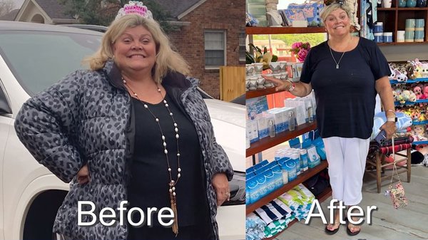 Success - Click the link to schedule your consultation today and start looking and feeling better!