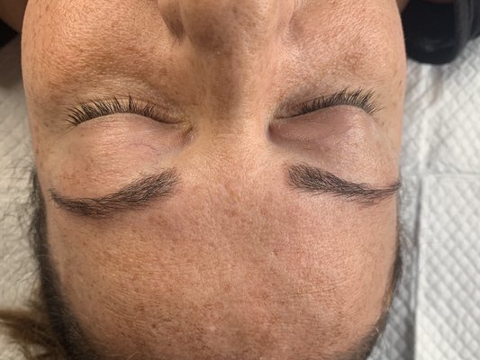 Microblading step by step - Each photo shows the steps in the microblading process. The first is the “before” photo, and is the clients natural brows. The second is the brow mapping process. The third photo is while numbing before the procedure begins. Last, is the “after” and finished brows :)