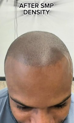 SMP, Touch Ups, and Scar Camouflage - Rediscover Your Confidence with Scalp Micropigmentation!
Are you ready to take control of your hairline and restore your confidence? Scalp Micropigmentation (SMP) is a cutting-edge solution designed to give you the look of a fuller, thicker head of hair—no surgery, no fuss, just amazing results!
SMP is a non-invasive, cosmetic procedure where pigment is applied to the scalp to replicate the natural look of hair follicles. Whether you're dealing with thinning hair, receding hairlines, or even complete hair loss, SMP creates the appearance of density and volume, giving you a fresh, natural look.
Instant Results: See a noticeable difference right away—no waiting for hair to grow.
Long-Lasting: Enjoy results that last for years with minimal maintenance.
Non-Surgical & Pain-Free: No needles, no scalpels—just a safe, gentle procedure.
Customizable: Tailored to fit your specific hairline, skin tone, and personal style.
Confidence Restored: Get the appearance of thicker hair and regain the confidence to live life to the fullest.
Perfect For:
Thinning or receding hairlines
Bald spots or areas of hair loss
Complete hair loss (for both men and women)
Creating a natural-looking, shaved head appearance
Touch Ups Available as well as scar camouflage!
Take the first step towards a new you! Our expert SMP artists will work with you to create a look that complements your natural features and style. Whether you're looking to enhance your hairline or completely transform your look, we’ve got you covered.
Call or Text To Book Your Consultation Today! SMP, Touch Ups, and Scar Camouflage - Rediscover Your Confidence with Scalp Micropigmentation!
Are you ready to take control of your hairline and restore your confidence? Scalp Micropigmentation (SMP) is a cutting-edge solution designed to give you the look of a fuller, thicker head of hair—no surgery, no fuss, just amazing results!
SMP is a non-invasive, cosmetic procedure where pigment is applied to the scalp to replicate the natural look of hair follicles. Whether you're dealing with thinning hair, receding hairlines, or even complete hair loss, SMP creates the appearance of density and volume, giving you a fresh, natural look.
Instant Results: See a noticeable difference right away—no waiting for hair to grow.
Long-Lasting: Enjoy results that last for years with minimal maintenance.
Non-Surgical & Pain-Free: No needles, no scalpels—just a safe, gentle procedure.
Customizable: Tailored to fit your specific hairline, skin tone, and personal style.
Confidence Restored: Get the appearance of thicker hair and regain the confidence to live life to the fullest.
Perfect For:
Thinning or receding hairlines
Bald spots or areas of hair loss
Complete hair loss (for both men and women)
Creating a natural-looking, shaved head appearance
Touch Ups Available as well as scar camouflage!
Take the first step towards a new you! Our expert SMP artists will work with you to create a look that complements your natural features and style. Whether you're looking to enhance your hairline or completely transform your look, we’ve got you covered.
Call or Text To Book Your Consultation Today!
