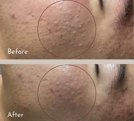 Facial Treatments - Skin care services