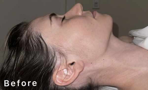 Face Drainage - Drainage Massages gently targets the lymphatic system just under your skin.
While touted as a way to flush toxins, it's mainly used to help with swelling from extra lymph fluid in
your tissues. Face Drainage - Drainage Massages gently targets the lymphatic system just under your skin.
While touted as a way to flush toxins, it's mainly used to help with swelling from extra lymph fluid in
your tissues.