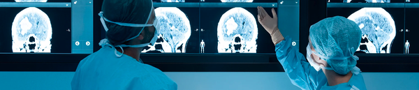 Brain Injury Attorneys - Why Are TBIs Legally Challenging?
Traumatic Brain Injury (TBI) is an injury to the brain causing a loss of consciousness lasting for less than 30 minutes, or alternatively, a period of confusion or disorientation which lasts for less than 30 minutes.
TBI’s or Post-concussive Syndrome (a mild TBI or MTBI) can occur from many types of impacts, including motorcycle, car, and truck accidents and/or fall injuries.
Symptoms can include:
Headaches, confusion, lightheadedness, dizziness, blurred vision, ringing in the ears (tinnitus), sleepiness, nausea, sensitivity to light and sound, “fuzzy” thinking, depression, sleep disturbances, visual disturbances, and even seizures.
Around 15% of people who suffer an MBTI experience post-concussive symptoms for more than a year after the initial injury was sustained.
Proving the damages caused by a brain injury can be difficult. In many cases, people with brain injuries may appear to be just fine to the outside, but they suffer from mild to severe symptoms that affect their activities of daily living, causing them to be unable to work or earn a living or, in some cases, even care for themselves. This damage does not appear on brain imaging tests like CT scans and MRIs.
A brain injury can result in memory problems, headaches, behavioral issues, and other conditions that may not be immediately obvious but must be made clear to get our clients the best possible compensation. For that reason, we bring in experts on brain injury, medical professionals, exhibit makers, and more. Our team understands how to prepare and present your case effectively and persuasively.
If you, or someone you know, has suffered a traumatic brain injury, contact the attorneys at Louis White Law for a free consultation. Brain Injury Attorneys - Why Are TBIs Legally Challenging?
Traumatic Brain Injury (TBI) is an injury to the brain causing a loss of consciousness lasting for less than 30 minutes, or alternatively, a period of confusion or disorientation which lasts for less than 30 minutes.
TBI’s or Post-concussive Syndrome (a mild TBI or MTBI) can occur from many types of impacts, including motorcycle, car, and truck accidents and/or fall injuries.
Symptoms can include:
Headaches, confusion, lightheadedness, dizziness, blurred vision, ringing in the ears (tinnitus), sleepiness, nausea, sensitivity to light and sound, “fuzzy” thinking, depression, sleep disturbances, visual disturbances, and even seizures.
Around 15% of people who suffer an MBTI experience post-concussive symptoms for more than a year after the initial injury was sustained.
Proving the damages caused by a brain injury can be difficult. In many cases, people with brain injuries may appear to be just fine to the outside, but they suffer from mild to severe symptoms that affect their activities of daily living, causing them to be unable to work or earn a living or, in some cases, even care for themselves. This damage does not appear on brain imaging tests like CT scans and MRIs.
A brain injury can result in memory problems, headaches, behavioral issues, and other conditions that may not be immediately obvious but must be made clear to get our clients the best possible compensation. For that reason, we bring in experts on brain injury, medical professionals, exhibit makers, and more. Our team understands how to prepare and present your case effectively and persuasively.
If you, or someone you know, has suffered a traumatic brain injury, contact the attorneys at Louis White Law for a free consultation.