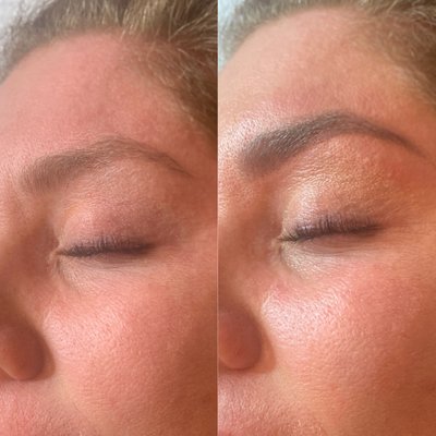 Before and after photos of eyebrow tinting and shaping - Having your eyebrows regularly tinted, trimmed and shaped can instantly give you a more refined and youthful appearance.
BENEFITS:
• Lifts the face and accentuates the eyes
•Eyebrows appear fuller, more defined and symmetrical.
•Smudge-proof results remove the need for “filling in” Before and after photos of eyebrow tinting and shaping - Having your eyebrows regularly tinted, trimmed and shaped can instantly give you a more refined and youthful appearance.
BENEFITS:
• Lifts the face and accentuates the eyes
•Eyebrows appear fuller, more defined and symmetrical.
•Smudge-proof results remove the need for “filling in”