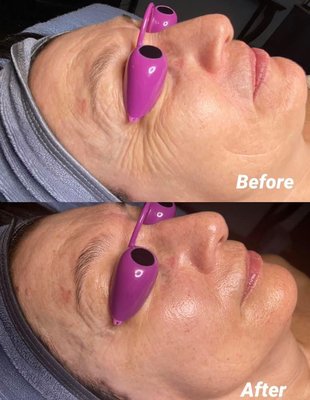 Targeted Facials - We specialize in Targeted Results-driven facials and professional skin care that also provides results. Guaranteed. Targeted Facials - We specialize in Targeted Results-driven facials and professional skin care that also provides results. Guaranteed.