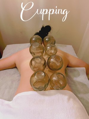 Cupping - Cupping therapy is a method that can draw out the dampness and coldness from the body, allowing them to penetrate through the skin tissues and eliminate the stagnant energy, thus invigorating the person both physically and mentally. Cupping - Cupping therapy is a method that can draw out the dampness and coldness from the body, allowing them to penetrate through the skin tissues and eliminate the stagnant energy, thus invigorating the person both physically and mentally.