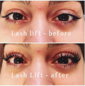 Before & After - Before and After Before & After - Before and After