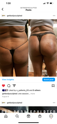 Before & After Results - Check out our happy customer results!