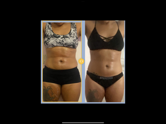 Our FDA approved, RN supervised Non Surgical Weight loss results. - These are before and after pictures from some our very own customers. Our FDA approved, RN supervised Non Surgical Weight loss results. - These are before and after pictures from some our very own customers.