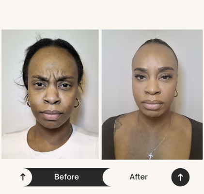Client Transformations - At ZK Aesthetics, we believe in celebrating confidence through transformation. Led by Cassie Lewis, FNP-C, our Sacramento-based clinic specializes in customized skin treatments, including Botox, fillers, and individualized skincare solutions. Explore our portfolio to see real results and inspiring client transformations, each reflecting our commitment to natural-looking enhancements and personalized care. Our goal is to ensure every client leaves feeling renewed, empowered, and truly like their best self. Client Transformations - At ZK Aesthetics, we believe in celebrating confidence through transformation. Led by Cassie Lewis, FNP-C, our Sacramento-based clinic specializes in customized skin treatments, including Botox, fillers, and individualized skincare solutions. Explore our portfolio to see real results and inspiring client transformations, each reflecting our commitment to natural-looking enhancements and personalized care. Our goal is to ensure every client leaves feeling renewed, empowered, and truly like their best self.