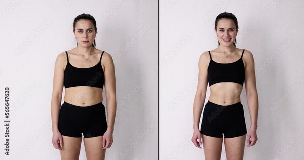 Before and after pictures - Treatments typically take 15 to 30 min each, non invasive, non-surgical and no downtime at all. These treatments are soothing massage throughout targeted areas. Before and after pictures - Treatments typically take 15 to 30 min each, non invasive, non-surgical and no downtime at all. These treatments are soothing massage throughout targeted areas.