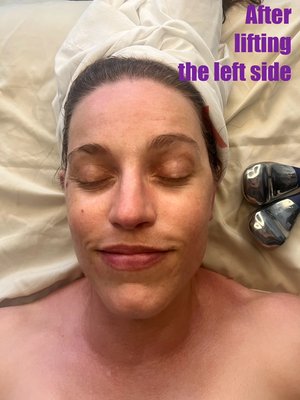 Face -lift massage - Face - lift is achieved by stimulating muscles , nourishing the skin. I usually do massage fist  to prepare the face and decolte for the facial, followed by toner and exfoliation.
Than I choose the serum and mask and start stimulating massage on 1/2 a facae to do get desired lifting effect.
after I do the other half , place a mask on . 
before removing mask I do Cryo therapy on the face to enhance the effect of tightening and reap the benefits of cooling.
If this will be microcurrent facial add on I continue with microcurrent- Bt-Sculpt stimulation.
finish with serum , cream and SPF if desired.