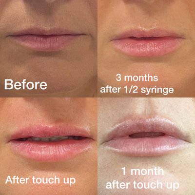 Before and After - Some before and after photos Before and After - Some before and after photos