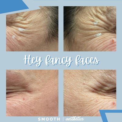 Beauty Services - If you’re looking for prevention or maintenance beauty services, we offer an array of aesthetic options from Botox, Kybella, micro needling and fillers from Juvéderm®, Radiesse®, and VersaTM, and more. Our mobile team is discreet and educated to help you reflect your best you! Beauty Services - If you’re looking for prevention or maintenance beauty services, we offer an array of aesthetic options from Botox, Kybella, micro needling and fillers from Juvéderm®, Radiesse®, and VersaTM, and more. Our mobile team is discreet and educated to help you reflect your best you!