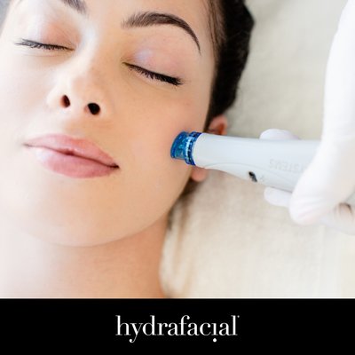 Hydrafacial - We offer a range of customized treatments designed to deeply cleanse, exfoliate and hydrate your skin. Each hydrafacial session targets specific skin concerns, including fine lines, wrinkles, acne, hyper pigmentation and uneven skin tones. The multi-step process combines cleansing, exfoliation, painless extraction, hydration, and antioxidant protection, leaving your skin instantly refreshed, radiant and glowing. Whether you're looking for a quick revitalization or an intensive skin renewal, our hydrafacial treatments provide visible, long-lasting results tailored to your unique skincare needs. Hydrafacial - We offer a range of customized treatments designed to deeply cleanse, exfoliate and hydrate your skin. Each hydrafacial session targets specific skin concerns, including fine lines, wrinkles, acne, hyper pigmentation and uneven skin tones. The multi-step process combines cleansing, exfoliation, painless extraction, hydration, and antioxidant protection, leaving your skin instantly refreshed, radiant and glowing. Whether you're looking for a quick revitalization or an intensive skin renewal, our hydrafacial treatments provide visible, long-lasting results tailored to your unique skincare needs.