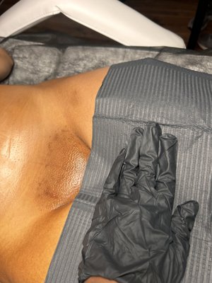 Brazilian Wax - Brazilian wax performed on my client using hard wax!