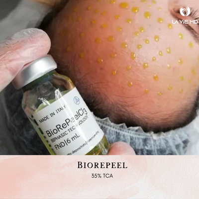 BioRePeel Treatment - BioRePeel facial treatment is an incredibly simple, effective, and painless TCA (trichloroacetic acid) peel. It is an innovative medical peel, that uses patented 2-phase technology to provide a bio-stimulating, revitalizing & peeling-like effect. The peel has 35% TCA.