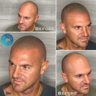 Two of our recent clients! - These clients came to us to restore their hairlines, we met with them in our studio in Glendale Arizona and developed a comprehensive plan, the clients are beyond happy with the results we achieved.