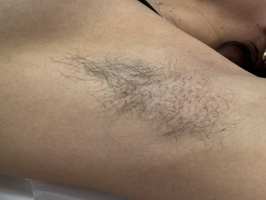 Before | Afters - Underarm wax $25
Lip wax $12
Chin wax $12
Full Face wax $60
Neck wax $15 Before | Afters - Underarm wax $25
Lip wax $12
Chin wax $12
Full Face wax $60
Neck wax $15