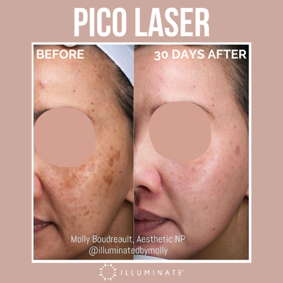 Skincare, Lasers & Devices - Our focus is to produce long-lasting, natural-looking results. Skincare, Lasers & Devices - Our focus is to produce long-lasting, natural-looking results.