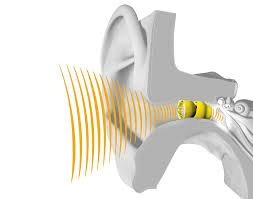 Hearing Loss Treatment - Call today to discuss how we treat hearing loss and what treatment plan will be best for your specific needs. Hearing Loss Treatment - Call today to discuss how we treat hearing loss and what treatment plan will be best for your specific needs.