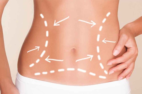 Body Sculpting - We offer Emsculpt, Ultrasonic cavitation, Morpheus 8 for body, to contour your look.  Book today.