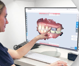 The Advantages of Same-Day Crowns in Dental Restoration - Same-day crowns have emerged as a notable advancement in dental care, offering numerous benefits for patients undergoing dental restoration procedures.
Traditionally, obtaining a dental crown required multiple visits and waiting periods. However, same-day crowns have streamlined this process by enabling dentists to design, fabricate, and place the crown in just one appointment.
One significant advantage of same-day crowns is their time efficiency. Unlike traditional crowns, which necessitate scheduling multiple visits, same-day crowns allow patients to complete the restoration process in a single appointment, saving time and inconvenience.
Precision fit is another key benefit of same-day crowns. Utilizing digital scanning and designing
technologies, dentists can ensure that the crown fits the tooth accurately, promoting both functionality and aesthetics.
Same-day crowns also offer a minimally invasive approach to dental restoration. By exposing the tooth only once during the procedure, the risk of bacterial exposure and complications is reduced, potentially leading to improved healing and fewer long-term issues.
Customization options further enhance the appeal of same-day crowns. Patients can collaborate with their dentist to select the shape, size, and shade of the crown, ensuring a personalized outcome that blends seamlessly with their natural teeth.
Durability is another important consideration in dental restorations, and same-day crowns excel in this aspect. Crafted from high-quality materials such as porcelain or zirconia, they offer longevity and reliability, providing patients with a durable solution for their dental needs.
In conclusion, same-day crowns represent a significant advancement in dental technology, offering
patients convenience, precision, and reliability in the restoration process. For individuals considering dental restoration, same-day crowns present a viable and efficient option worth exploring further.
At Dr. Diehl's office, we are proud to offer same-day crown services, ensuring that our patients can
benefit from the advantages of this innovative approach to dental restoration. The Advantages of Same-Day Crowns in Dental Restoration - Same-day crowns have emerged as a notable advancement in dental care, offering numerous benefits for patients undergoing dental restoration procedures.
Traditionally, obtaining a dental crown required multiple visits and waiting periods. However, same-day crowns have streamlined this process by enabling dentists to design, fabricate, and place the crown in just one appointment.
One significant advantage of same-day crowns is their time efficiency. Unlike traditional crowns, which necessitate scheduling multiple visits, same-day crowns allow patients to complete the restoration process in a single appointment, saving time and inconvenience.
Precision fit is another key benefit of same-day crowns. Utilizing digital scanning and designing
technologies, dentists can ensure that the crown fits the tooth accurately, promoting both functionality and aesthetics.
Same-day crowns also offer a minimally invasive approach to dental restoration. By exposing the tooth only once during the procedure, the risk of bacterial exposure and complications is reduced, potentially leading to improved healing and fewer long-term issues.
Customization options further enhance the appeal of same-day crowns. Patients can collaborate with their dentist to select the shape, size, and shade of the crown, ensuring a personalized outcome that blends seamlessly with their natural teeth.
Durability is another important consideration in dental restorations, and same-day crowns excel in this aspect. Crafted from high-quality materials such as porcelain or zirconia, they offer longevity and reliability, providing patients with a durable solution for their dental needs.
In conclusion, same-day crowns represent a significant advancement in dental technology, offering
patients convenience, precision, and reliability in the restoration process. For individuals considering dental restoration, same-day crowns present a viable and efficient option worth exploring further.
At Dr. Diehl's office, we are proud to offer same-day crown services, ensuring that our patients can
benefit from the advantages of this innovative approach to dental restoration.