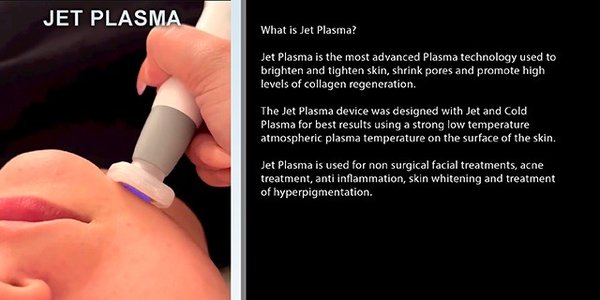 JET PLASMA FACIAL - Jet plasma is one of the best anti-aging treatments on the market with NO DOWN TIME! It’s pain-free and can be performed in under an hour. Perfect for fine lines and wrinkles, texture and pore size, acne, rosacea and skin toning. Service includes Jet Plasma, LED light, and NeoGenesis stem cell serum. BEST VALUE! For best results a series of 4 to 8 weekly treatments is recommended. We offer a “buy 3, get 1 free” package for $600--a $200 savings when you purchase the package. (See “Packages” Tab on Menu) JET PLASMA FACIAL - Jet plasma is one of the best anti-aging treatments on the market with NO DOWN TIME! It’s pain-free and can be performed in under an hour. Perfect for fine lines and wrinkles, texture and pore size, acne, rosacea and skin toning. Service includes Jet Plasma, LED light, and NeoGenesis stem cell serum. BEST VALUE! For best results a series of 4 to 8 weekly treatments is recommended. We offer a “buy 3, get 1 free” package for $600--a $200 savings when you purchase the package. (See “Packages” Tab on Menu)