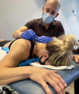 Dry Needling Therapy - Dry needling is an effective treatment option for people dealing with myofascial or muscular pain.  Myofascial pain syndrome, or trigger points, can be a source of pain and limit function.  These trigger points or “knots” can be found in any muscle throughout the body.  Dry needling is a specialized treatment for trigger points provided by physical therapists who have undergone advanced training in the safety and efficacy of the intervention. It is one possible treatment option, usually combined with other techniques including exercises, to manage myofascial pain. Our physical therapists can perform a thorough evaluation to help determine if you are a good candidate for this treatment as part of a program designed to reduce your pain and improve your function.