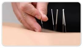 Accupuncture - We offer acupuncture services . Each session lasts Thirty Minutes. The first session is 130. This includes your exam. Each session afterwards is 60 dollars for your session . Acupuncture has been used for thousands of years and works great for different ailments.