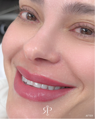 Lip Blush & Lip Neutralization - Customized lip blush and lip neutralization designed to enhance the natural lip shape, balance uneven or cool tones, and create a brighter, more defined appearance. Each color is carefully selected for the client’s skin tone, natural lip color, and desired result. Lip Blush & Lip Neutralization - Customized lip blush and lip neutralization designed to enhance the natural lip shape, balance uneven or cool tones, and create a brighter, more defined appearance. Each color is carefully selected for the client’s skin tone, natural lip color, and desired result.