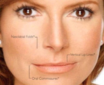 Fillers For Wrinkles & Face Lines! - Fill your unwanted facial wrinkles and fine lines with Juvaderm! Book your appointment today! Fillers For Wrinkles & Face Lines! - Fill your unwanted facial wrinkles and fine lines with Juvaderm! Book your appointment today!