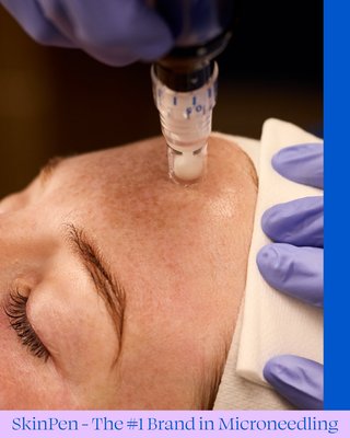 Microneedling - It looks like you're setting up a new portfolio project for Microneedling at 512 Aesthetics. While the default text in your draft currently describes a kitchen remodel (definitely a different kind of "resurfacing"!), you’ll want something that highlights the skin rejuvenation benefits.
Here are a few options ranging from clinical to glow-focused:
Option 1: Results-Driven (Professional & Informative)
"Transform your skin texture and tone with our professional Microneedling treatment. Also known as Collagen Induction Therapy, this procedure uses clinical-grade technology to create controlled micro-injuries, stimulating your body’s natural healing process. It is highly effective for reducing the appearance of acne scars, fine lines, and enlarged pores, resulting in smoother, firmer, and more youthful-looking skin Microneedling - It looks like you're setting up a new portfolio project for Microneedling at 512 Aesthetics. While the default text in your draft currently describes a kitchen remodel (definitely a different kind of "resurfacing"!), you’ll want something that highlights the skin rejuvenation benefits.
Here are a few options ranging from clinical to glow-focused:
Option 1: Results-Driven (Professional & Informative)
"Transform your skin texture and tone with our professional Microneedling treatment. Also known as Collagen Induction Therapy, this procedure uses clinical-grade technology to create controlled micro-injuries, stimulating your body’s natural healing process. It is highly effective for reducing the appearance of acne scars, fine lines, and enlarged pores, resulting in smoother, firmer, and more youthful-looking skin