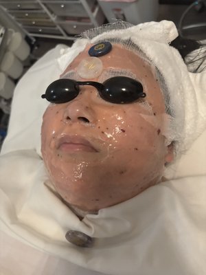 Customized Facials - The Signature Facial is for any skin type, completely customizable. Includes a thorough consultation, double cleansing, analysis of the skin, steam, enzyme and extracting of blackheads, face, neck and shoulder gua sha stone massage. Hot towels. Customized mask, toner, then moisturizer, SPF and eye cream. Customized Facials - The Signature Facial is for any skin type, completely customizable. Includes a thorough consultation, double cleansing, analysis of the skin, steam, enzyme and extracting of blackheads, face, neck and shoulder gua sha stone massage. Hot towels. Customized mask, toner, then moisturizer, SPF and eye cream.