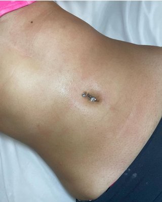 Sugaring Hair Removal - Specializing in Sugaring Hair Removal Sugaring Hair Removal - Specializing in Sugaring Hair Removal