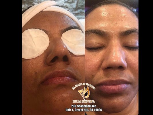 Signature Facial - This facial is ideal for first-time facial clients for any skin type even clients with sensitive skin. Includes: Skin analysis, steamed deep double cleanse, enzymatic exfoliation, customized mask, hot towel, and shoulder massage. Signature Facial - This facial is ideal for first-time facial clients for any skin type even clients with sensitive skin. Includes: Skin analysis, steamed deep double cleanse, enzymatic exfoliation, customized mask, hot towel, and shoulder massage.