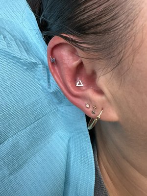 Body Piercings - Common piercing locations include the earlobes, cartilage, nostrils, navel. Piercings can be performed using needles  done by professional piercers in sterile environments. The type of jewelry used varies, with options such as studs, rings, barbells, and more. Body piercings can be for aesthetic, cultural, or personal expression purposes, and they require proper aftercare to prevent infection and promote healing.
