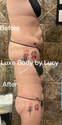Body Contouring - Body Contouring
. Reduce Fat Cells. Fat Reductions. Non-Invasive Treatments. No Surgery Required. No downtime.
Laser Lipo: 30 minute sessions
Body Contouring: 60 minute sessions
60 minute Body contouring packages include Laser Lipo, Body RF & ultrasonic Cavitation. Body Contouring - Body Contouring
. Reduce Fat Cells. Fat Reductions. Non-Invasive Treatments. No Surgery Required. No downtime.
Laser Lipo: 30 minute sessions
Body Contouring: 60 minute sessions
60 minute Body contouring packages include Laser Lipo, Body RF & ultrasonic Cavitation.