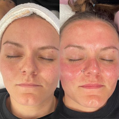 Advanced Customized Facials - Result Driven Skincare Treatments . Every treatment is customized to the persons skincare needs. Advanced Customized Facials - Result Driven Skincare Treatments . Every treatment is customized to the persons skincare needs.