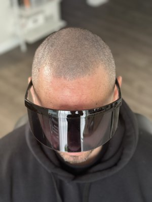 3 day Scalp Micropigmentation group training - The forthcoming training program scheduled for January 15-18, 2024, encompasses an academically oriented curriculum focusing on Scalp Micropigmentation (SMP). This instructive initiative aims to impart comprehensive knowledge and practical skills relevant to the art and technique of SMP, a specialized form of cosmetic pigmentation designed to address hair loss concerns.
Participants will engage in a structured learning environment, wherein theoretical foundations and anatomical considerations will be elucidated, offering a profound understanding of scalp physiology and pigmentation intricacies. The training will further integrate hands-on sessions, allowing attendees to acquire proficiency in the application of SMP methodologies under the guidance of seasoned practitioners.
This academic endeavor endeavors to equip participants with a nuanced comprehension of SMP principles, encompassing pigment selection, technique refinement, and client consultation. Moreover, the training program is strategically designed to foster critical thinking and adaptability, ensuring that participants emerge with a skill set aligned with contemporary industry standards.
By amalgamating theoretical discourse with practical application, the training aspires to cultivate a cohort of adept practitioners poised to contribute meaningfully to the evolving landscape of Scalp Micropigmentation. The scheduled dates of January 15-18, 2024, mark a pivotal juncture for those seeking to embark upon or enhance their proficiency in this specialized field. 3 day Scalp Micropigmentation group training - The forthcoming training program scheduled for January 15-18, 2024, encompasses an academically oriented curriculum focusing on Scalp Micropigmentation (SMP). This instructive initiative aims to impart comprehensive knowledge and practical skills relevant to the art and technique of SMP, a specialized form of cosmetic pigmentation designed to address hair loss concerns.
Participants will engage in a structured learning environment, wherein theoretical foundations and anatomical considerations will be elucidated, offering a profound understanding of scalp physiology and pigmentation intricacies. The training will further integrate hands-on sessions, allowing attendees to acquire proficiency in the application of SMP methodologies under the guidance of seasoned practitioners.
This academic endeavor endeavors to equip participants with a nuanced comprehension of SMP principles, encompassing pigment selection, technique refinement, and client consultation. Moreover, the training program is strategically designed to foster critical thinking and adaptability, ensuring that participants emerge with a skill set aligned with contemporary industry standards.
By amalgamating theoretical discourse with practical application, the training aspires to cultivate a cohort of adept practitioners poised to contribute meaningfully to the evolving landscape of Scalp Micropigmentation. The scheduled dates of January 15-18, 2024, mark a pivotal juncture for those seeking to embark upon or enhance their proficiency in this specialized field.
