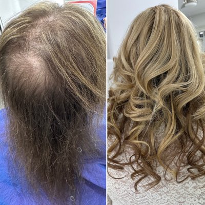 Hair toppers/hair extensions Microlines top hair/ hair extensions K-tip, hair tape extensions, I - tip, Top Herr hair toppers - If your suffering from hair loss and need a more hair on top, not just the sides of the head. We are specialized in giving you more hair for thickness, covering missing areas of the head, adding more hair on top with a professional real human hair topper.
Most women and men suffer from hair loss on the top of their head. We also can add more thickness and length with hair extensions of different varieties. we offer several types and kinds of toppers.
Some women are going and getting hair extensions, but they need more hair on top and it can look mismatched, so you may need a hair topper so it looks more complete.
If you have alopecia, hair loss from cancer, hormonal thinning, age related hair loss, trichotillomania, or any other kinds of hair loss.
If your interested in learning more about this, then schedule a consultation we would love to have you come in for more information on how you can add more hair on top or get more thickness and length. Or just plain help grow your hair back. Hair toppers/hair extensions Microlines top hair/ hair extensions K-tip, hair tape extensions, I - tip, Top Herr hair toppers - If your suffering from hair loss and need a more hair on top, not just the sides of the head. We are specialized in giving you more hair for thickness, covering missing areas of the head, adding more hair on top with a professional real human hair topper.
Most women and men suffer from hair loss on the top of their head. We also can add more thickness and length with hair extensions of different varieties. we offer several types and kinds of toppers.
Some women are going and getting hair extensions, but they need more hair on top and it can look mismatched, so you may need a hair topper so it looks more complete.
If you have alopecia, hair loss from cancer, hormonal thinning, age related hair loss, trichotillomania, or any other kinds of hair loss.
If your interested in learning more about this, then schedule a consultation we would love to have you come in for more information on how you can add more hair on top or get more thickness and length. Or just plain help grow your hair back.