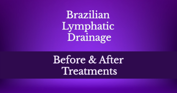 Lymphatic Drainage - Lymphatic drainage massage is often used to relieve lymphedema symptoms following breast cancer surgery and related treatments, Brazilian butt lifts, and tummy tucks, in addition to other types of plastic surgery. It is also used to reduce symptoms of rheumatoid arthritis, fibromyalgia, lipedema, chronic venous insufficiency, and improve the appearance of skin health.
Discover a healthier and more vibrant life with a lymphatic treatment plan. This spectacular modality can help contour your face and body, reduce bloating, scar formation, improve skin quality, assist in the removal of metabolic waste, and improve circulation.
Sometimes known as manual lymphatic drainage, this gentle service is often used to help relieve swelling due to a medical treatment, or an illness of the lymphatic system. Its purpose is to reduce edema and promote the distribution of leukocytes to enhance immune response, and lymph function.
Normally the lymphatic system collects lymph sending it first to a network of lymph vessels and nodes before returning it to the heart. When this process is interrupted lymph pools leading to swelling in the affected area. This may cause bloating, puffiness, and cause stretch marks and cellulite to appear more noticeable. Lymphatic Drainage - Lymphatic drainage massage is often used to relieve lymphedema symptoms following breast cancer surgery and related treatments, Brazilian butt lifts, and tummy tucks, in addition to other types of plastic surgery. It is also used to reduce symptoms of rheumatoid arthritis, fibromyalgia, lipedema, chronic venous insufficiency, and improve the appearance of skin health.
Discover a healthier and more vibrant life with a lymphatic treatment plan. This spectacular modality can help contour your face and body, reduce bloating, scar formation, improve skin quality, assist in the removal of metabolic waste, and improve circulation.
Sometimes known as manual lymphatic drainage, this gentle service is often used to help relieve swelling due to a medical treatment, or an illness of the lymphatic system. Its purpose is to reduce edema and promote the distribution of leukocytes to enhance immune response, and lymph function.
Normally the lymphatic system collects lymph sending it first to a network of lymph vessels and nodes before returning it to the heart. When this process is interrupted lymph pools leading to swelling in the affected area. This may cause bloating, puffiness, and cause stretch marks and cellulite to appear more noticeable.