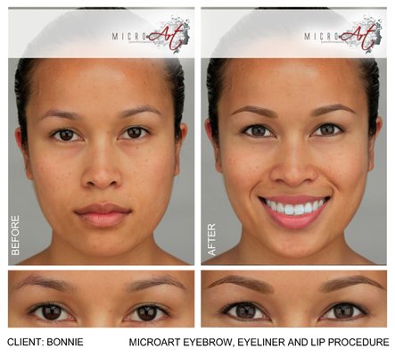 Eyebrows - MicroArt is a proprietary technology developed by acclaimed Hollywood entrepreneur and former special effects makeup expert Tanya York — with the help of a team of mechanical engineers and cosmetic biochemists.

The goal was to develop a makeup procedure that would look more natural than any form of permanent or semi-permanent makeup and eliminate all side effects. Side effects of other forms of permanent makeup range from a short-term such as downtime, scabbing, bruising and heavy bleeding to the long-term side effects such as scarring, inks that change colors on the skin and the shape of the makeup that changes over time due to the skin’s aging process.

MicroArt has eliminated all such side effects through:

Equipment: Specialized equipment developed by MicroArt for unrivaled precision.
Clinics: MicroArt procedures are performed in a certified, professional medical office passing regular, stringent County Health Department inspections.
Products: Special, natural pigments developed that will not change color and are hypoallergenic (safe for your skin).
Technique: A technique developed over the years to ensure the ideal, custom shape and color is provided to each client
Technicians: All technicians are personally trained for months, and certified, by Master Micro Artist Tanya York. MicroArt Technicians are not licensed to perform services on Ms. York’s clients until their work is indistinguishable from hers.
There are no other forms of permanent cosmetics like it.