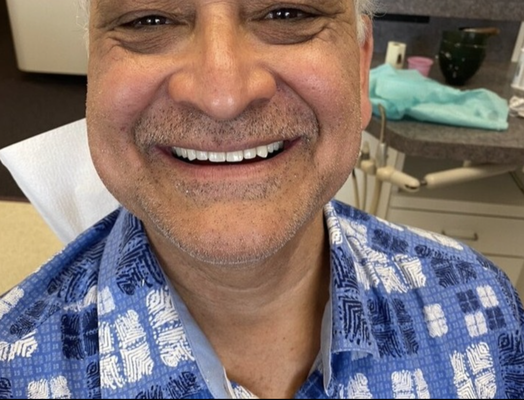 Full Mouth Rehab - Swipe to see this amazing full mouth rehab