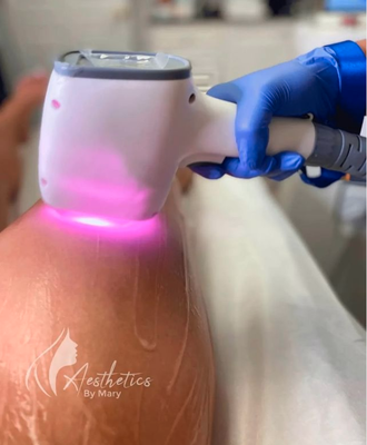 Laser Hair Removal - We all have hair in our bodies that we wish didn't have. From our legs to our faces to our underarms, we spend hours of our lives shaving, waxing, and removing that unwanted hair! LASER HAIR REMOVAL is one of the most effective ways to remove unwanted body hair!
