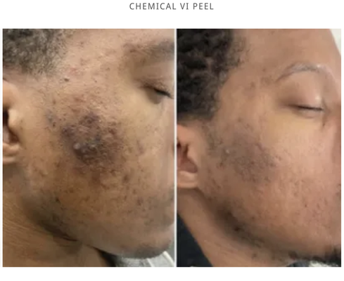 Chemical Peel - chemical peels near los angeles
best chemical peel near los angeles
chemical peel near me near los angeles
chemical peel treatment near los angeles
chemical peel near beverly hills
affordable chemical peel near los angeles
chemical peel spa near los angeles
chemical peel facial near los angeles
glow up chemical peel near los angeles
deep chemical peel near los angeles
vi peel near los angeles
glycolic acid peel near los angeles
salicylic acid peel near los angeles
tca peel near los angeles
chemical peel for acne scars near los angeles
chemical peel for dark spots near los angeles
chemical peel before and after near los angeles
celebrity chemical peel near beverly hills
top chemical peel providers near los angeles
chemical peel packages near los angeles
best med spa for chemical peels near los angeles
chemical peel for hyperpigmentation near los angeles
customized chemical peel treatment near los angeles
sensitive skin chemical peel near los angeles
chemical peels near La Cañada Flintridge
best chemical peel in La Cañada Flintridge
chemical peel treatment La Cañada Flintridge
chemical peel spa La Cañada Flintridge
affordable chemical peel La Cañada Flintridge
chemical peel facial La Cañada Flintridge
chemical peel for acne scars La Cañada Flintridge
chemical peel for hyperpigmentation La Cañada Flintridge
chemical peel for fine lines La Cañada Flintridge
chemical peel for sun damage La Cañada Flintridge
chemical peel for melasma La Cañada Flintridge
chemical peel for dark spots La Cañada Flintridge
chemical peel for uneven skin tone La Cañada Flintridge
chemical peel for wrinkles La Cañada Flintridge
chemical peel for dull skin La Cañada Flintridge
chemical peel for textured skin La Cañada Flintridge
chemical peel for enlarged pores La Cañada Flintridge
chemical peel for oily skin La Cañada Flintridge
chemical peel for dry skin La Cañada Flintridge
chemical peel for sensitive skin La Cañada Flintridge
chemical peel for mature skin La Cañada Flintridge
chemical peel for acne La Cañada Flintridge
chemical peel for scarring La Cañada Flintridge
chemical peel for pigmentation La Cañada Flintridge
chemical peel for texture La Cañada Flintridge
chemical peel for glow La Cañada Flintridge
chemical peel for rejuvenation La Cañada Flintridge
chemical peel for collagen boost La Cañada Flintridge
chemical peel for skin resurfacing La Cañada Flintridge
chemical peel for skin clarity La Cañada Flintridge
chemical peel for skin radiance La Cañada Flintridge
chemical peel for skin brightening La Cañada Flintridge
chemical peel for skin tightening La Cañada Flintridge
chemical peel for skin smoothing La Cañada Flintridge
chemical peel for skin texture La Cañada Flintridge
chemical peel for skin tone La Cañada Flintridge
chemical peel for skin renewal La Cañada Flintridge
chemical peel for skin rejuvenation La Cañada Flintridge
chemical peel for skin restoration La Cañada Flintridge
chemical peel for skin healing La Cañada Flintridge
chemical peel for skin exfoliation La Cañada Flintridge
chemical peel for skin regeneration La Cañada Flintridge
chemical peel for skin detox La Cañada Flintridge
chemical peel for skin purification La Cañada Flintridge
chemical peel for skin revitalization La Cañada Flintridge
chemical peel for skin enhancement La Cañada Flintridge
chemical peel for skin improvement La Cañada Flintridge
chemical peel for skin care La Cañada Flintridge
chemical peel for skin therapy La Cañada Flintridge
chemical peel for skin treatment La Cañada Flintridge
chemical peel for skin solution La Cañada Flintridge
chemical peel for skin problem La Cañada Flintridge
chemical peel for skin concern La Cañada Flintridge
chemical peel for skin issue La Cañada Flintridge
chemical peel for skin condition La Cañada Flintridge
chemical peel for skin disorder La Cañada Flintridge
chemical peel for skin ailment La Cañada Flintridge
chemical peel for skin blemish La Cañada Flintridge
chemical peel for skin imperfection La Cañada Flintridge
chemical peel for skin flaw La Cañada Flintridge
chemical peel for skin mark La Cañada Flintridge
chemical peel for skin scar La Cañada Flintridge
chemical peel for skin spot La Cañada Flintridge
chemical peel for skin discoloration La Cañada Flintridge
chemical peel for skin pigmentation La Cañada Flintridge
chemical peel for skin tone correction La Cañada Flintridge
chemical peel for skin lightening La Cañada Flintridge
chemical peel for skin brightening La Cañada Flintridge
chemical peel for skin whitening La Cañada Flintridge
chemical peel for skin glow La Cañada Flintridge
chemical peel for skin radiance La Cañada Flintridge
chemical peel for skin luminosity La Cañada Flintridge
chemical peel for skin shine La Cañada Flintridge
chemical peel for skin sparkle La Cañada Flintridge
chemical peel for skin brilliance La Cañada Flintridge
chemical peel for skin clarity La Cañada Flintridge
chemical peel for skin transparency La Cañada Flintridge Chemical Peel - chemical peels near los angeles
best chemical peel near los angeles
chemical peel near me near los angeles
chemical peel treatment near los angeles
chemical peel near beverly hills
affordable chemical peel near los angeles
chemical peel spa near los angeles
chemical peel facial near los angeles
glow up chemical peel near los angeles
deep chemical peel near los angeles
vi peel near los angeles
glycolic acid peel near los angeles
salicylic acid peel near los angeles
tca peel near los angeles
chemical peel for acne scars near los angeles
chemical peel for dark spots near los angeles
chemical peel before and after near los angeles
celebrity chemical peel near beverly hills
top chemical peel providers near los angeles
chemical peel packages near los angeles
best med spa for chemical peels near los angeles
chemical peel for hyperpigmentation near los angeles
customized chemical peel treatment near los angeles
sensitive skin chemical peel near los angeles
chemical peels near La Cañada Flintridge
best chemical peel in La Cañada Flintridge
chemical peel treatment La Cañada Flintridge
chemical peel spa La Cañada Flintridge
affordable chemical peel La Cañada Flintridge
chemical peel facial La Cañada Flintridge
chemical peel for acne scars La Cañada Flintridge
chemical peel for hyperpigmentation La Cañada Flintridge
chemical peel for fine lines La Cañada Flintridge
chemical peel for sun damage La Cañada Flintridge
chemical peel for melasma La Cañada Flintridge
chemical peel for dark spots La Cañada Flintridge
chemical peel for uneven skin tone La Cañada Flintridge
chemical peel for wrinkles La Cañada Flintridge
chemical peel for dull skin La Cañada Flintridge
chemical peel for textured skin La Cañada Flintridge
chemical peel for enlarged pores La Cañada Flintridge
chemical peel for oily skin La Cañada Flintridge
chemical peel for dry skin La Cañada Flintridge
chemical peel for sensitive skin La Cañada Flintridge
chemical peel for mature skin La Cañada Flintridge
chemical peel for acne La Cañada Flintridge
chemical peel for scarring La Cañada Flintridge
chemical peel for pigmentation La Cañada Flintridge
chemical peel for texture La Cañada Flintridge
chemical peel for glow La Cañada Flintridge
chemical peel for rejuvenation La Cañada Flintridge
chemical peel for collagen boost La Cañada Flintridge
chemical peel for skin resurfacing La Cañada Flintridge
chemical peel for skin clarity La Cañada Flintridge
chemical peel for skin radiance La Cañada Flintridge
chemical peel for skin brightening La Cañada Flintridge
chemical peel for skin tightening La Cañada Flintridge
chemical peel for skin smoothing La Cañada Flintridge
chemical peel for skin texture La Cañada Flintridge
chemical peel for skin tone La Cañada Flintridge
chemical peel for skin renewal La Cañada Flintridge
chemical peel for skin rejuvenation La Cañada Flintridge
chemical peel for skin restoration La Cañada Flintridge
chemical peel for skin healing La Cañada Flintridge
chemical peel for skin exfoliation La Cañada Flintridge
chemical peel for skin regeneration La Cañada Flintridge
chemical peel for skin detox La Cañada Flintridge
chemical peel for skin purification La Cañada Flintridge
chemical peel for skin revitalization La Cañada Flintridge
chemical peel for skin enhancement La Cañada Flintridge
chemical peel for skin improvement La Cañada Flintridge
chemical peel for skin care La Cañada Flintridge
chemical peel for skin therapy La Cañada Flintridge
chemical peel for skin treatment La Cañada Flintridge
chemical peel for skin solution La Cañada Flintridge
chemical peel for skin problem La Cañada Flintridge
chemical peel for skin concern La Cañada Flintridge
chemical peel for skin issue La Cañada Flintridge
chemical peel for skin condition La Cañada Flintridge
chemical peel for skin disorder La Cañada Flintridge
chemical peel for skin ailment La Cañada Flintridge
chemical peel for skin blemish La Cañada Flintridge
chemical peel for skin imperfection La Cañada Flintridge
chemical peel for skin flaw La Cañada Flintridge
chemical peel for skin mark La Cañada Flintridge
chemical peel for skin scar La Cañada Flintridge
chemical peel for skin spot La Cañada Flintridge
chemical peel for skin discoloration La Cañada Flintridge
chemical peel for skin pigmentation La Cañada Flintridge
chemical peel for skin tone correction La Cañada Flintridge
chemical peel for skin lightening La Cañada Flintridge
chemical peel for skin brightening La Cañada Flintridge
chemical peel for skin whitening La Cañada Flintridge
chemical peel for skin glow La Cañada Flintridge
chemical peel for skin radiance La Cañada Flintridge
chemical peel for skin luminosity La Cañada Flintridge
chemical peel for skin shine La Cañada Flintridge
chemical peel for skin sparkle La Cañada Flintridge
chemical peel for skin brilliance La Cañada Flintridge
chemical peel for skin clarity La Cañada Flintridge
chemical peel for skin transparency La Cañada Flintridge