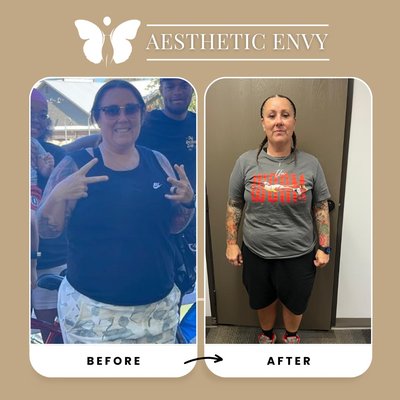 Weight Loss Treatment - Incredible Transformation! ✨

Proud to share this journey — 40 pounds down and feeling stronger than ever! 💪

Sometimes, it's not just about the weight you lose, but the confidence you gain.

Book your consultation today @ 916.333.4906