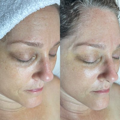 Facials - I offer a wide variety of customized facials where results meet relaxation! Reach out for a free consultation and we can discuss which facial is right for you! Facials - I offer a wide variety of customized facials where results meet relaxation! Reach out for a free consultation and we can discuss which facial is right for you!