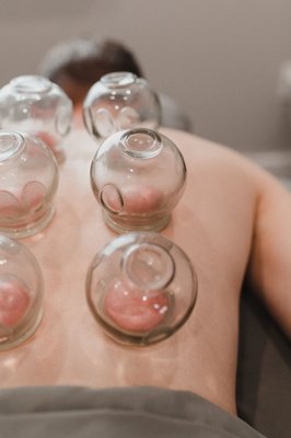 Cupping - Fire cupping has been practiced for thousands of years for a reason… It’s amazing! Cupping increases circulation, reduces pain, decreases inflammation and activates the immune system. It also feels amazing and can provide instant relief.